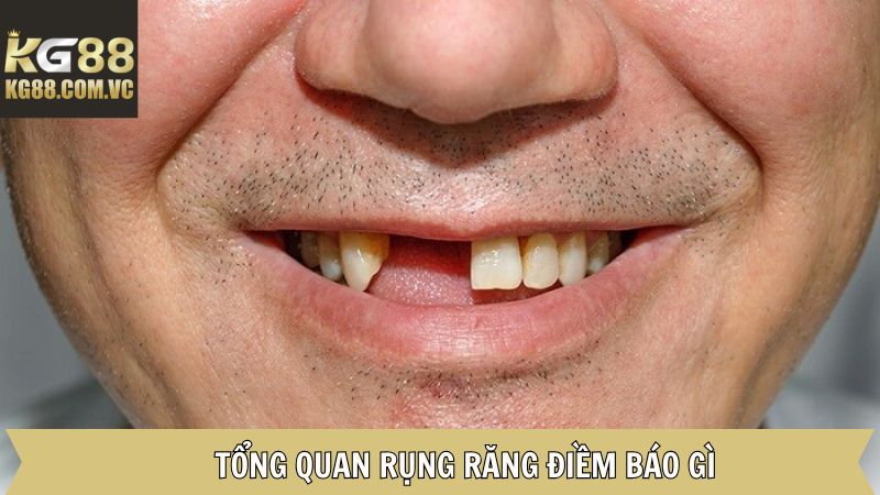 Giải thích về rụng răng điềm báo gì
